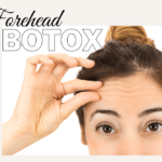 forehead botox treatments blog cover image