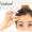 forehead botox treatments blog cover image